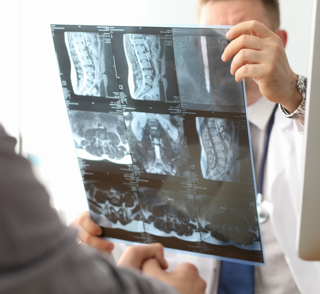 xray